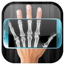 X Ray Scanner APK icon